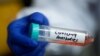 کرونا وائرس: کیا 'پیسو امیونائزیشن' کا طریقۂ علاج کارگر ہو سکتا ہے؟ 